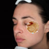 Skin Consultation