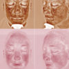 Skin Consultation